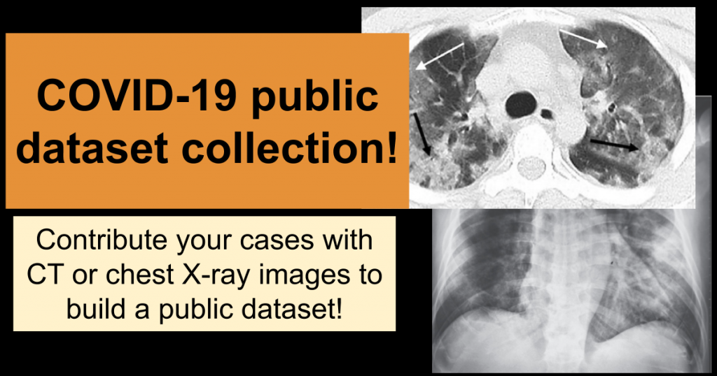 Building a public COVID-19 dataset of X-ray and CT scans ...
